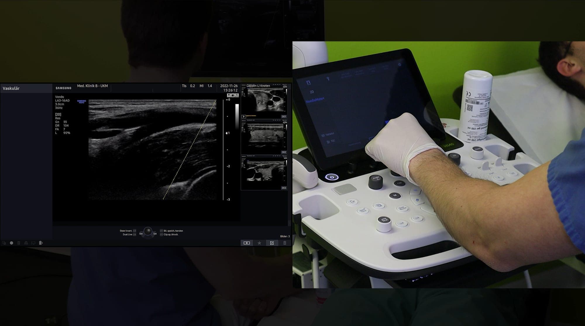 Bedienvideo für ein Ultraschallgerät